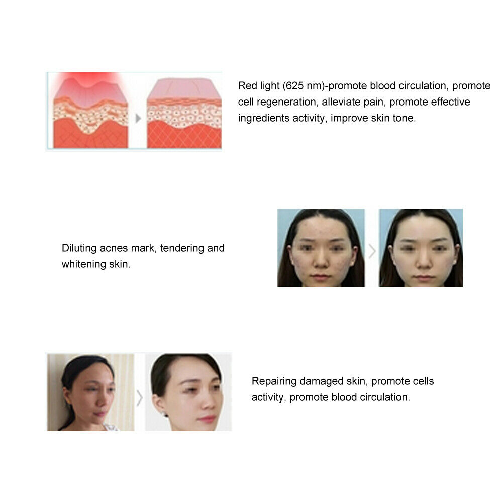 Skin Rejuvenation Anti-aging Facial Beauty Machine - MOSKBITE